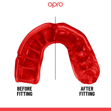 OPRO Platinum Fangz Mouthguard