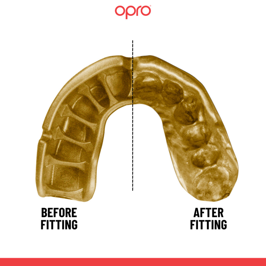 OPRO Self-Fit GEN5 Gold Grillz Mouthguard