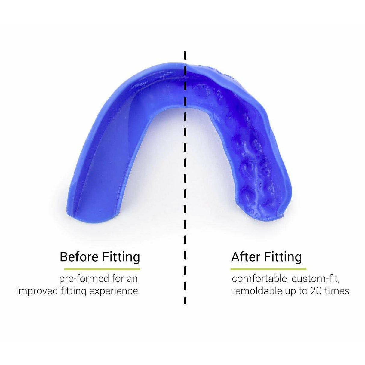 Sisu 3D Custom Fit Mouthguard